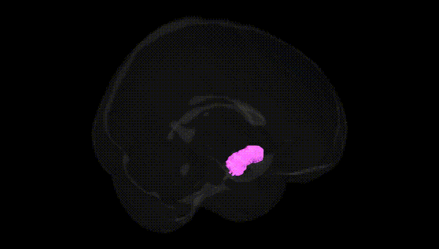 Full Brain Black