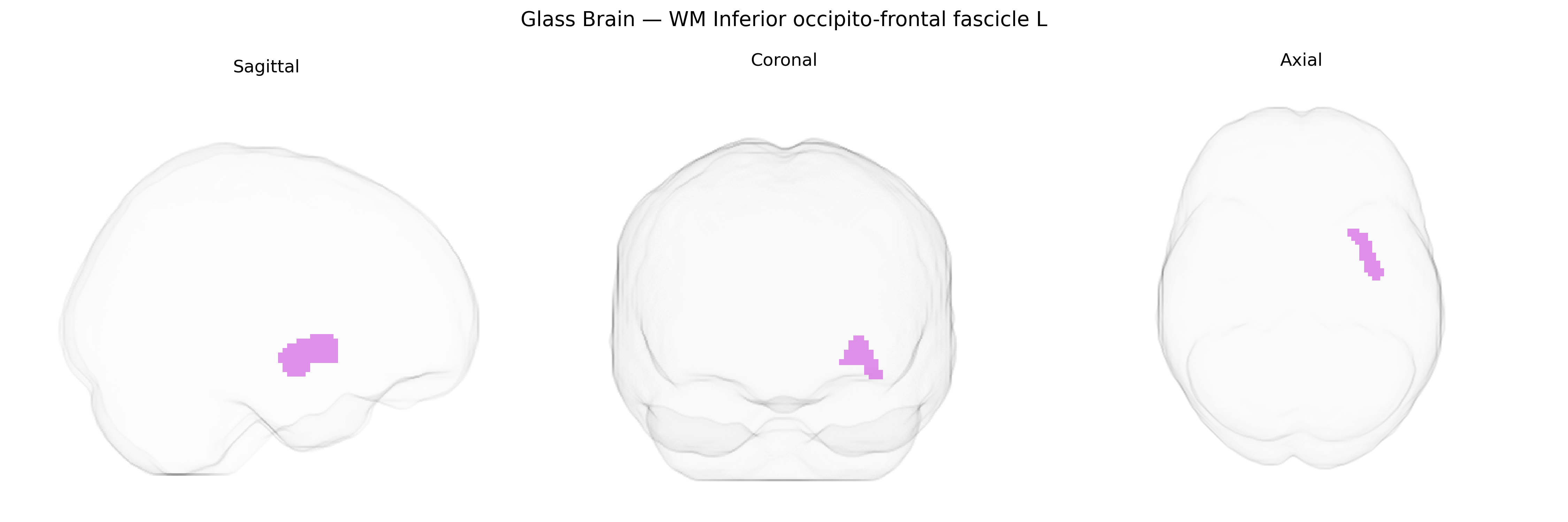 Triplanar Ghost Brain