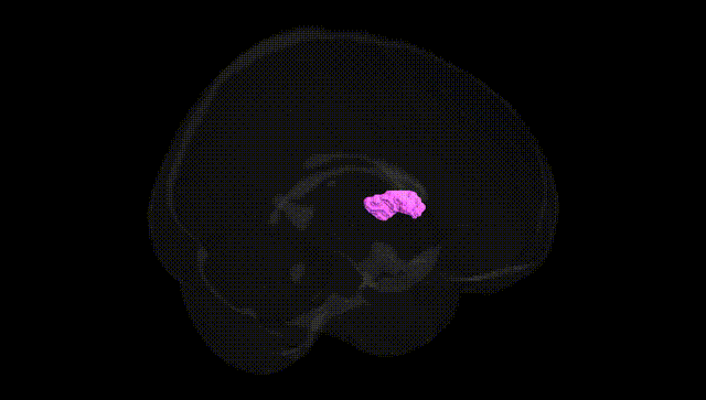 Full Brain Black