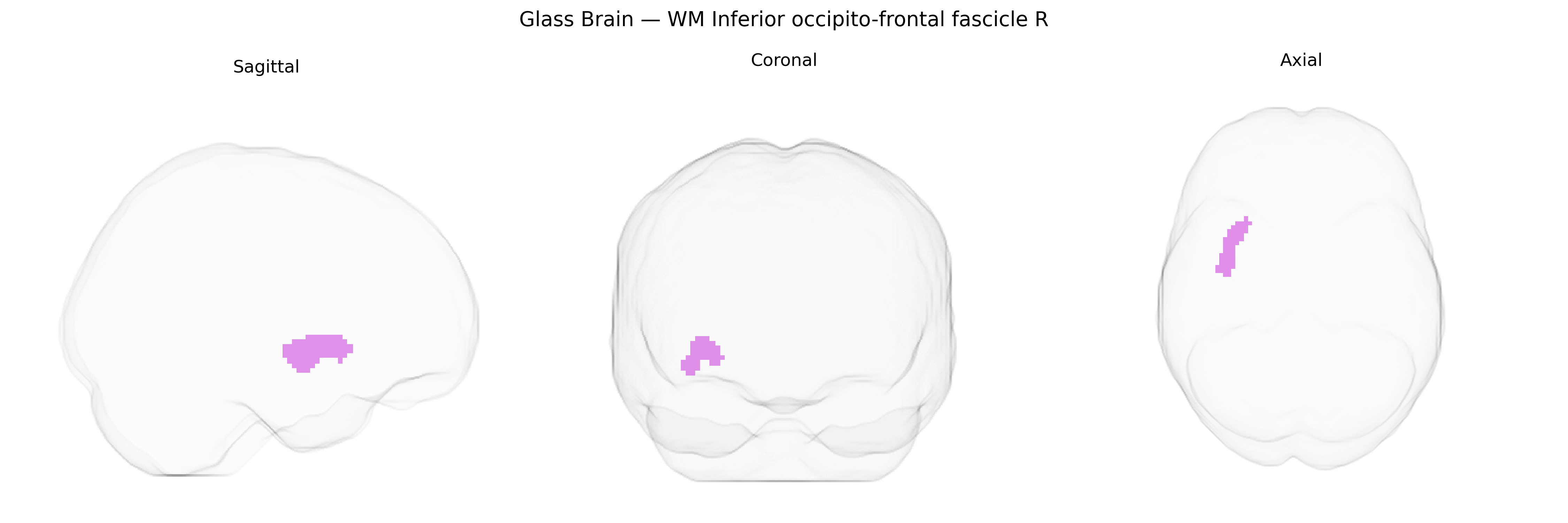 Triplanar Ghost Brain