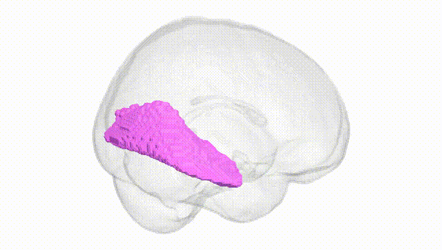 Full Brain White