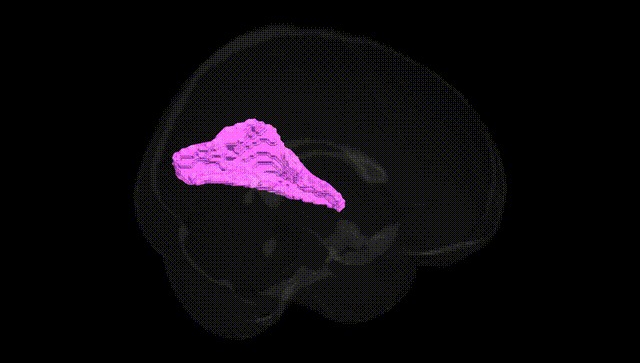 Full Brain Black