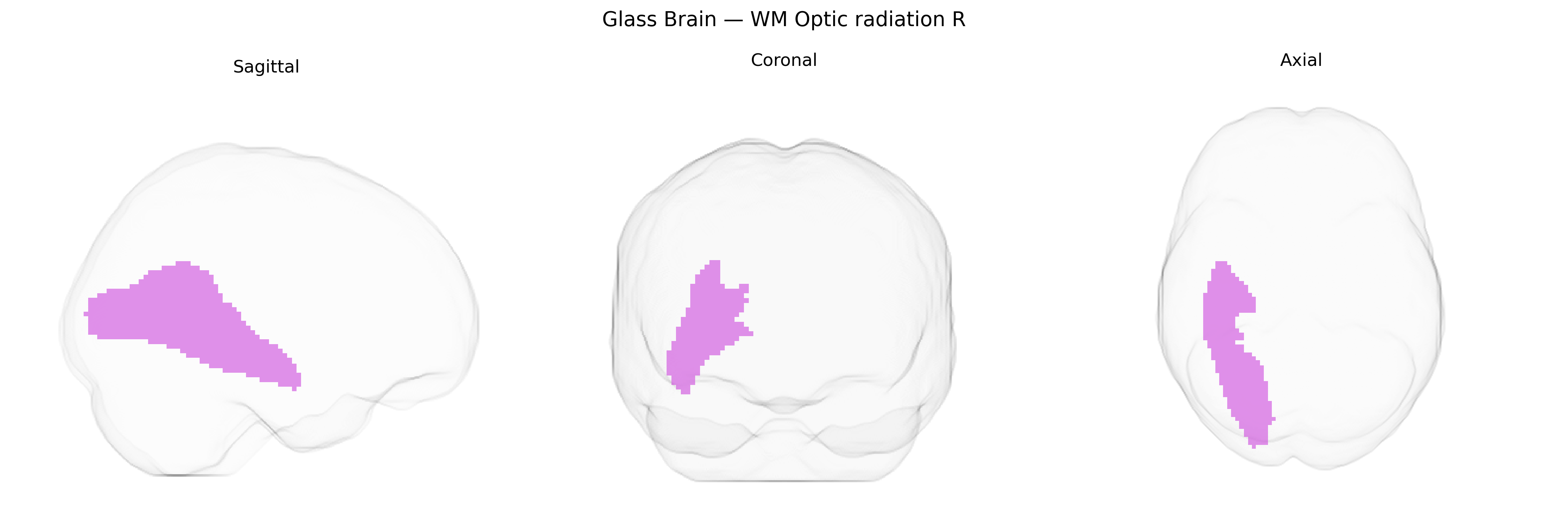 Triplanar Ghost Brain