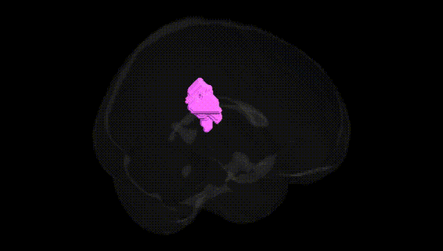 Full Brain Black