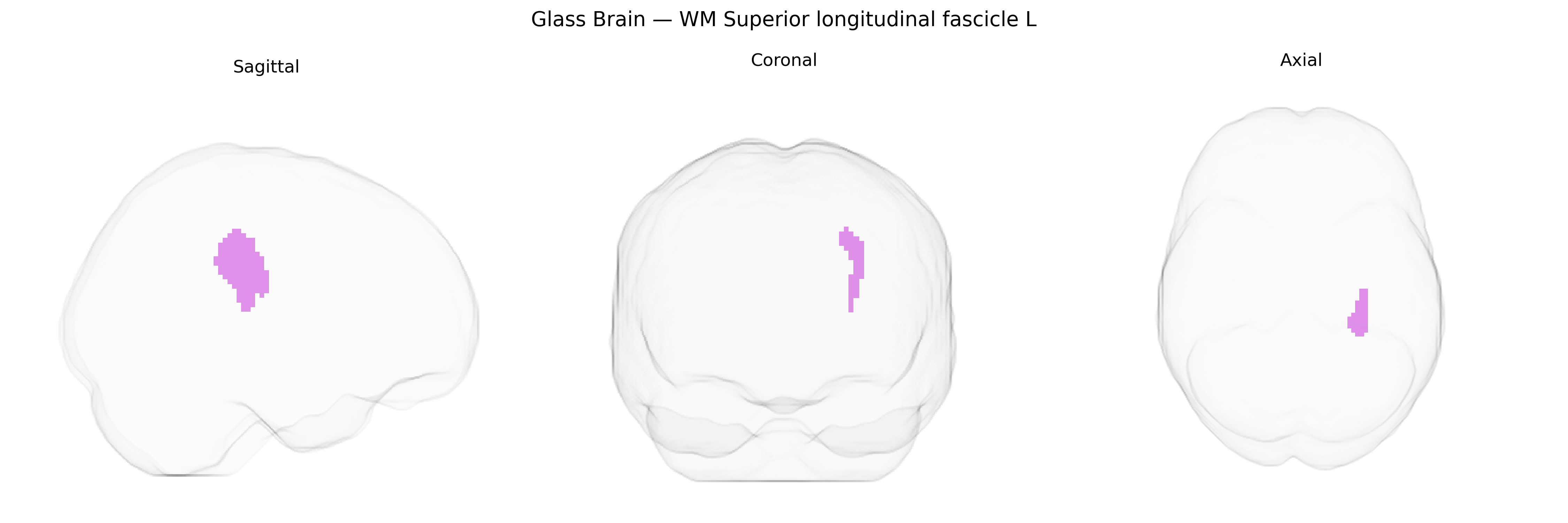 Triplanar Ghost Brain