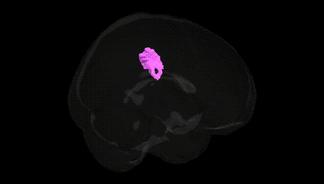 Full Brain Black