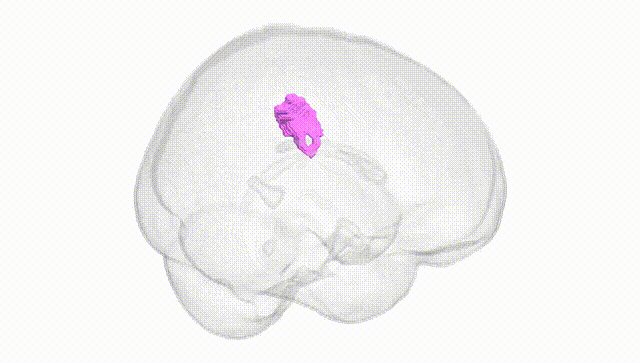 Full Brain White