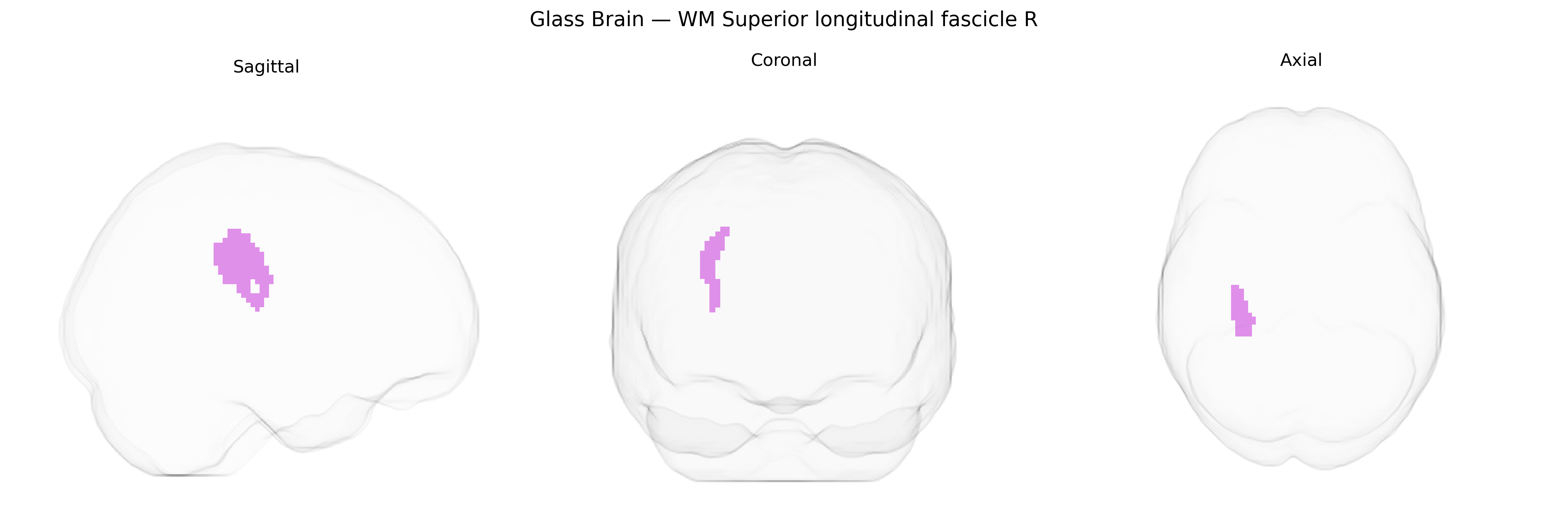 Triplanar Ghost Brain