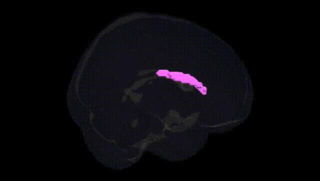 Full Brain Black