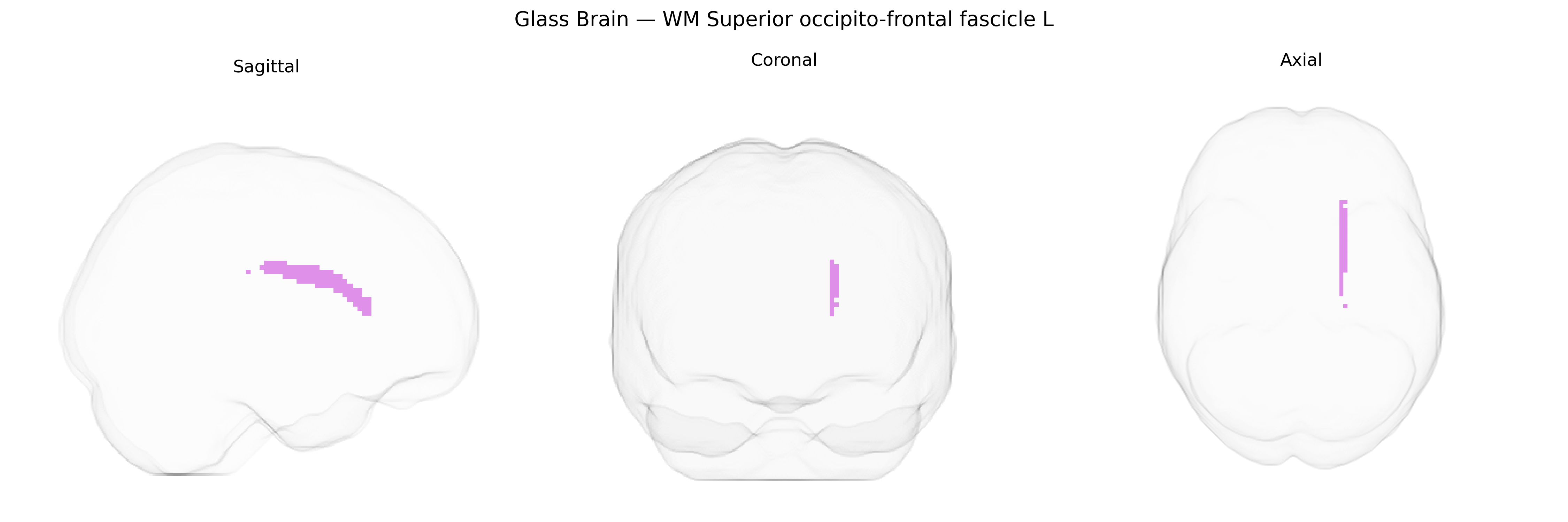 Triplanar Ghost Brain