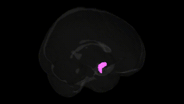 Full Brain Black