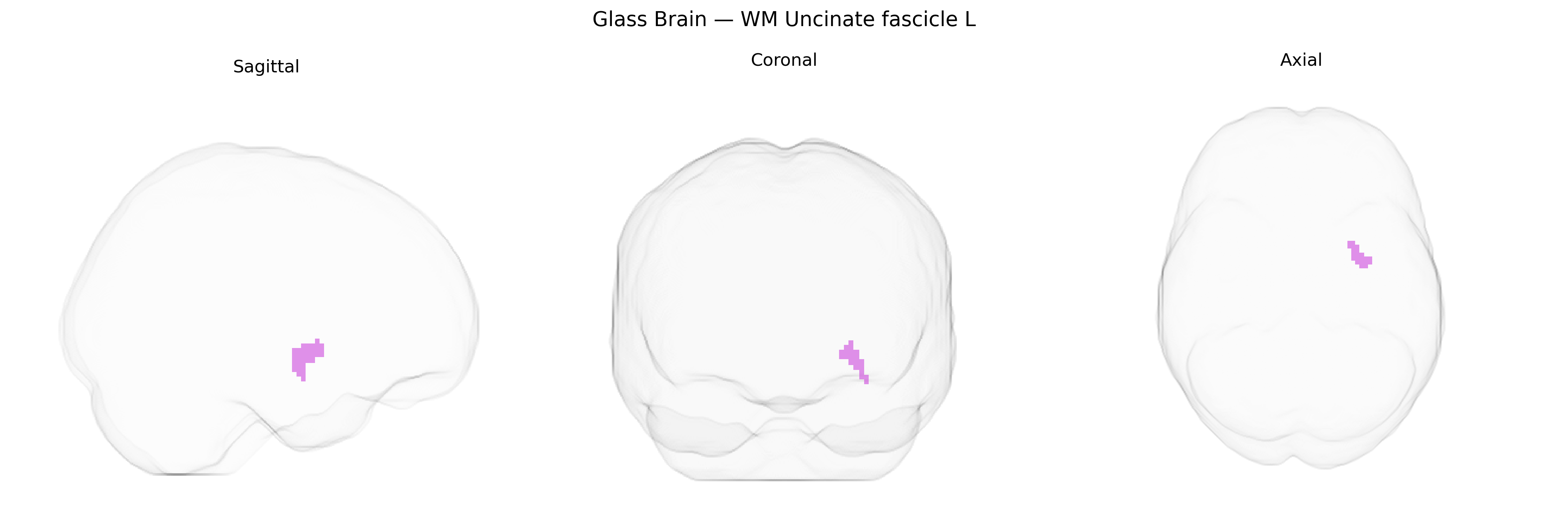 Triplanar Ghost Brain