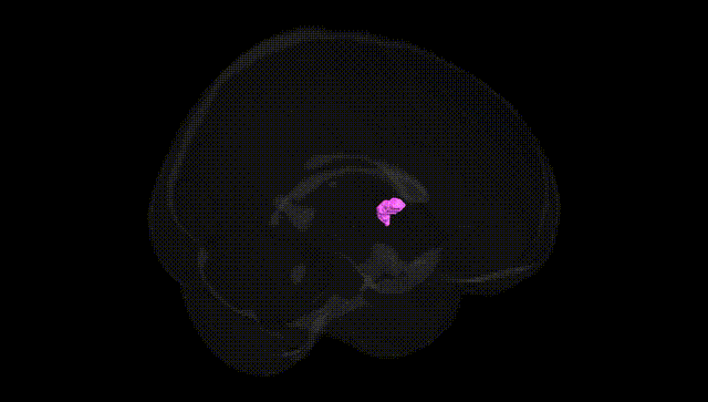 Full Brain Black