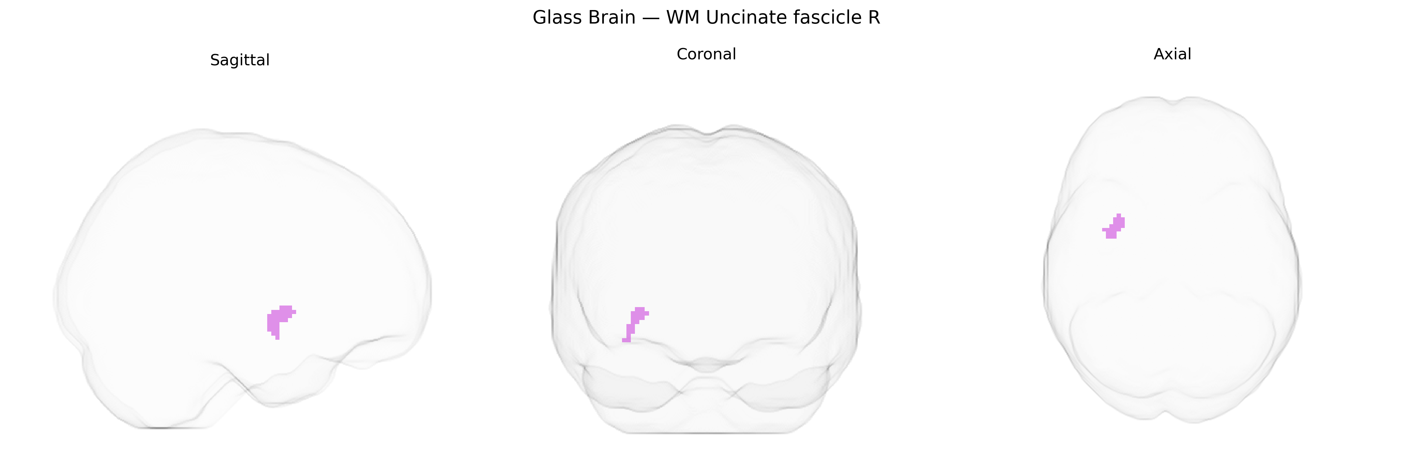 Triplanar Ghost Brain