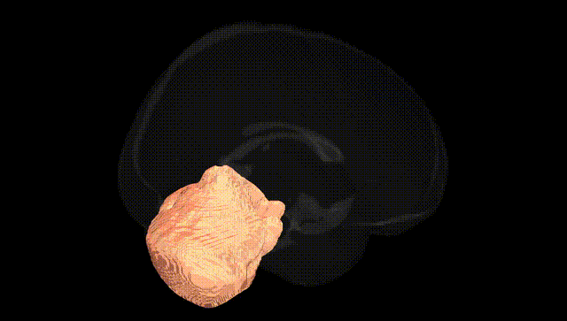 Full Brain Black