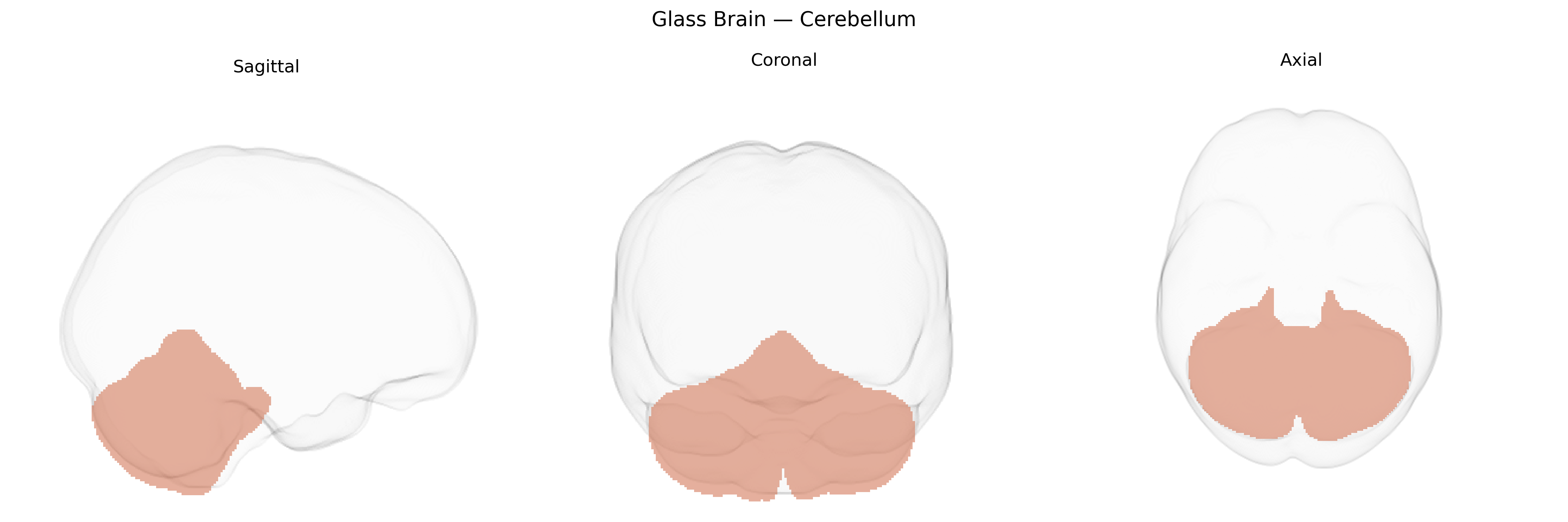 Triplanar Ghost Brain
