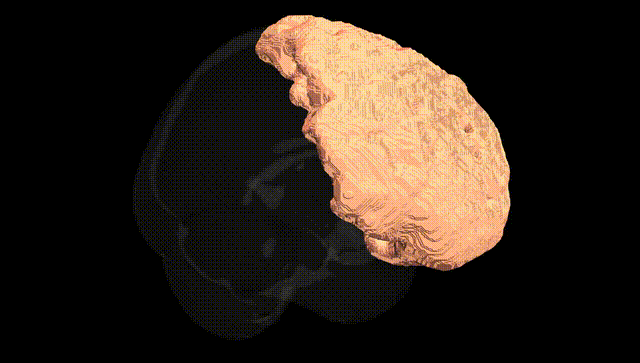 Full Brain Black