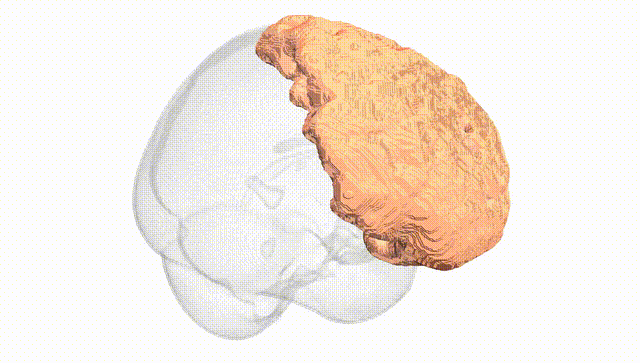 Full Brain White
