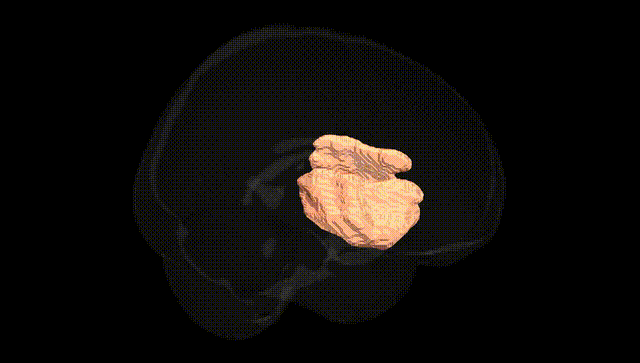 Full Brain Black