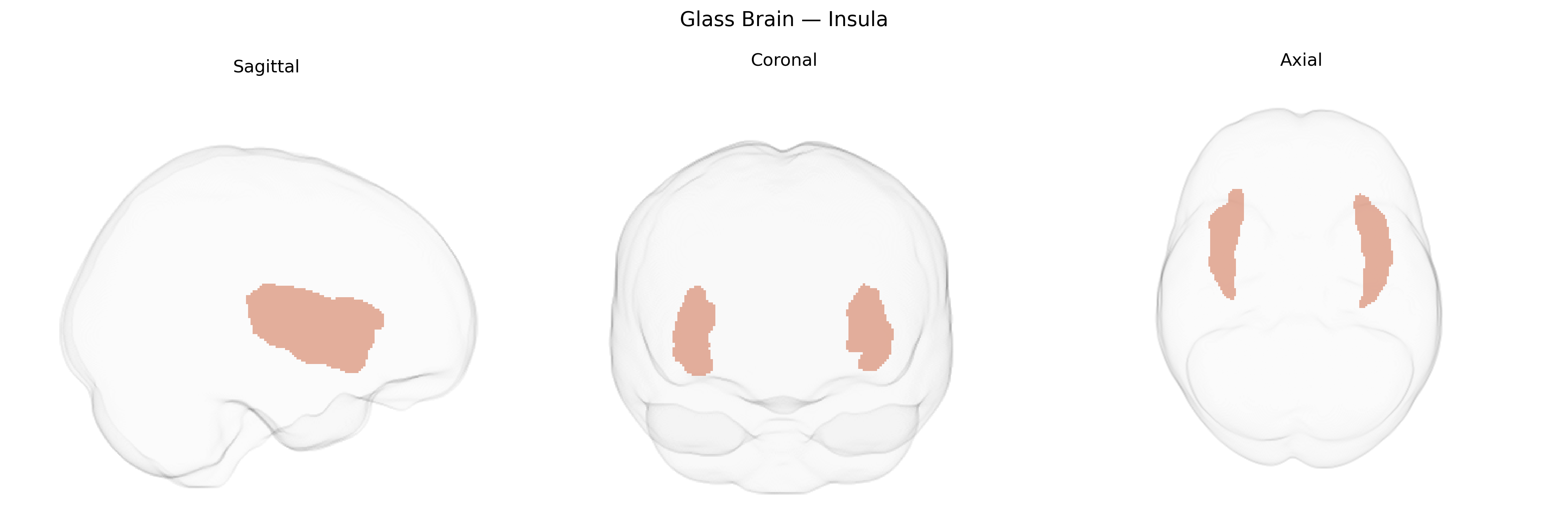 Triplanar Ghost Brain