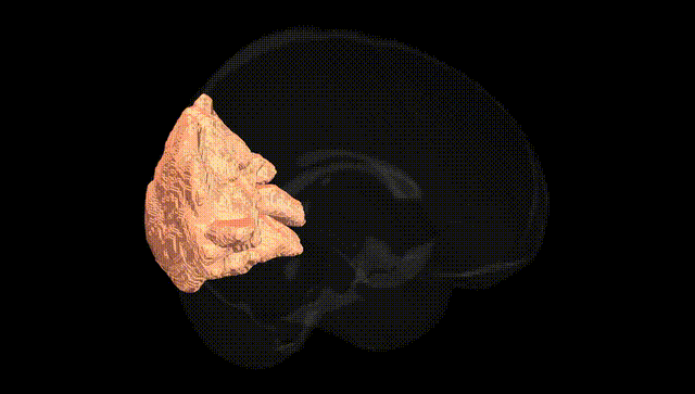 Full Brain Black