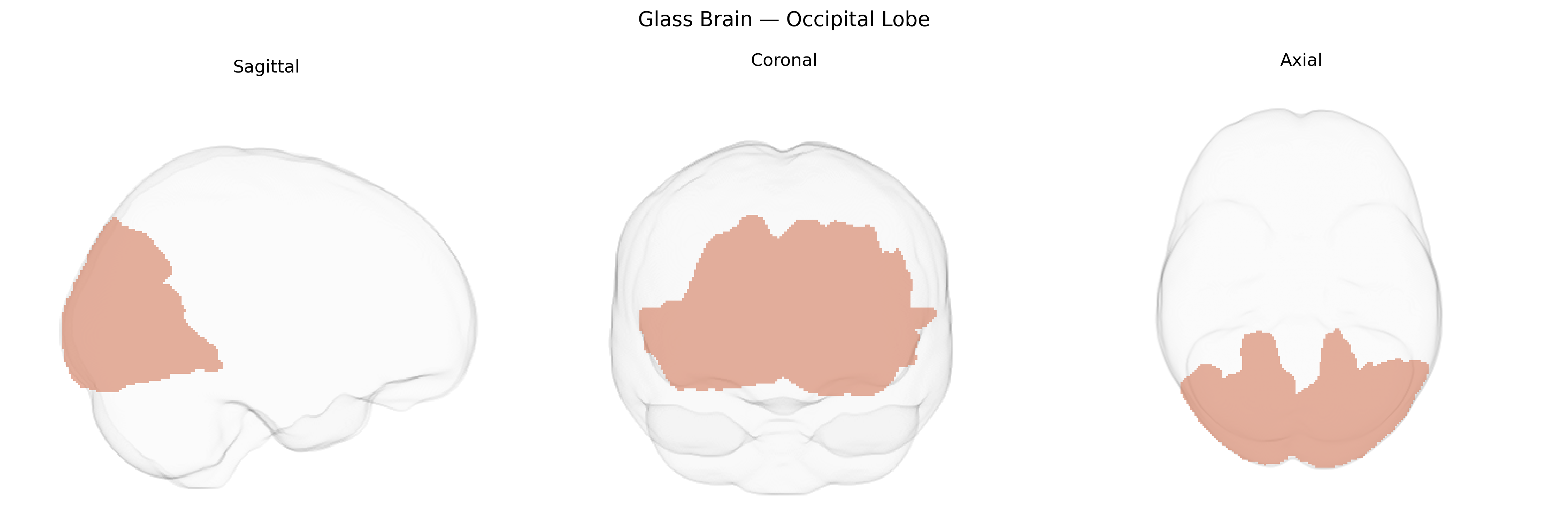 Triplanar Ghost Brain