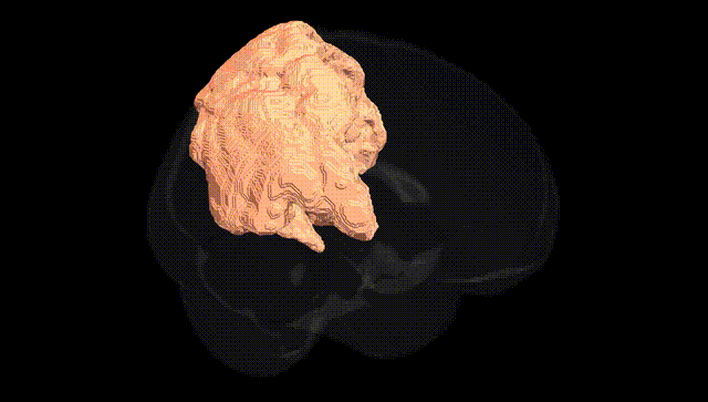 Full Brain Black