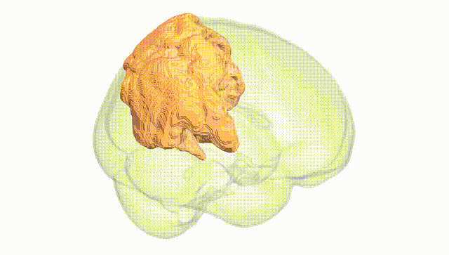 Full Brain White