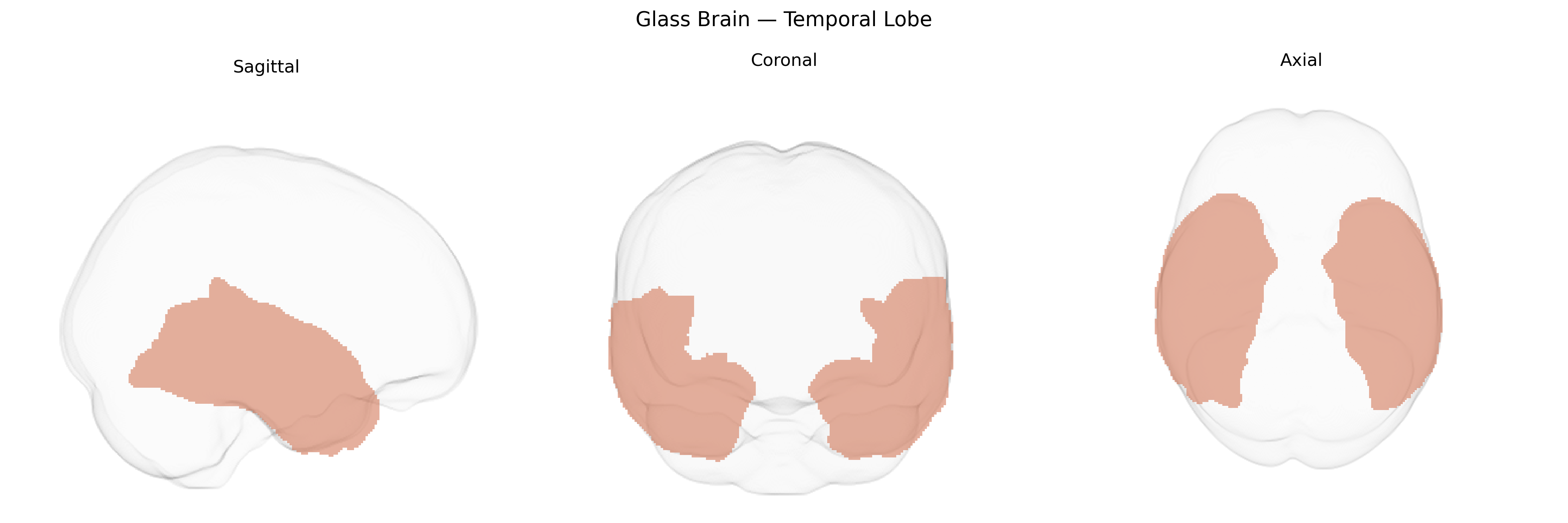 Triplanar Ghost Brain
