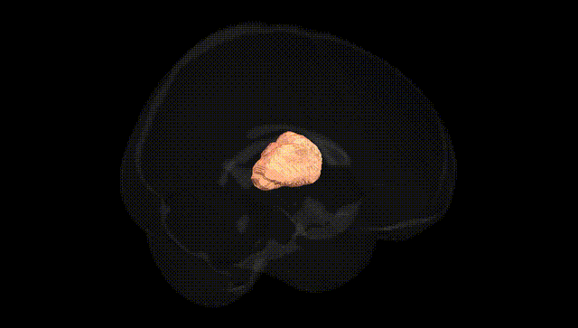 Full Brain Black