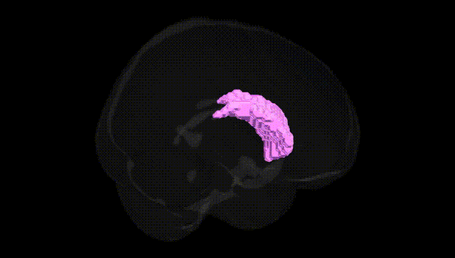 Full Brain Black