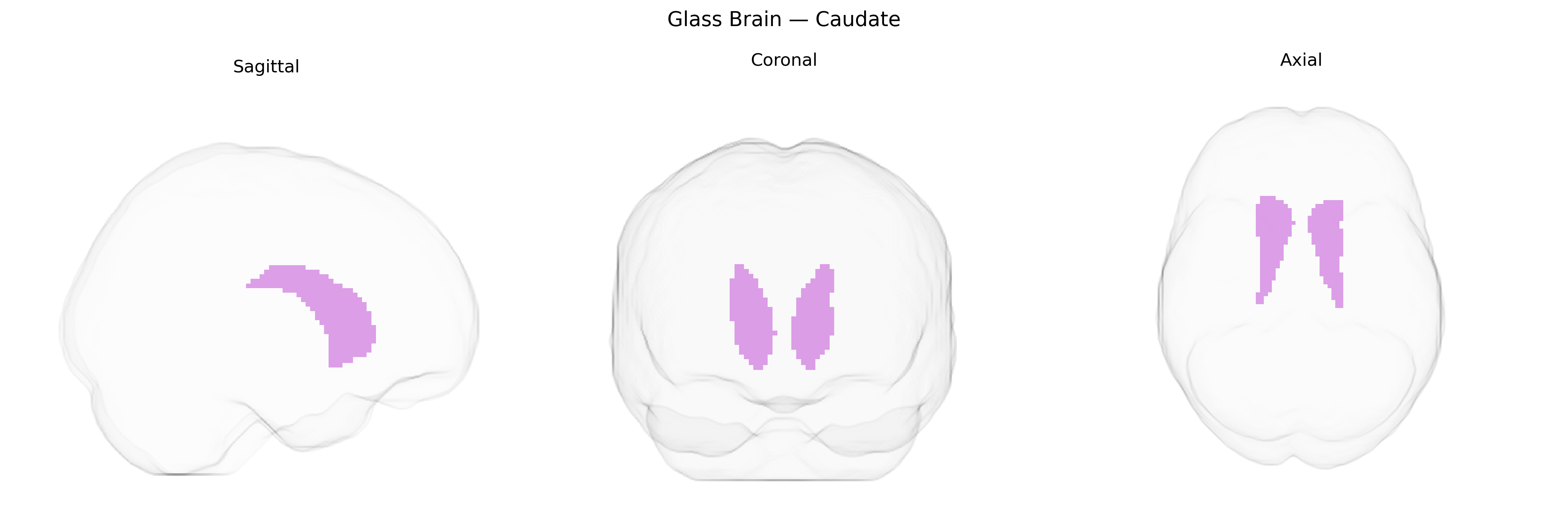 Triplanar Ghost Brain