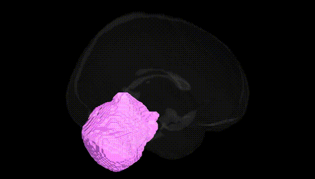 Full Brain Black