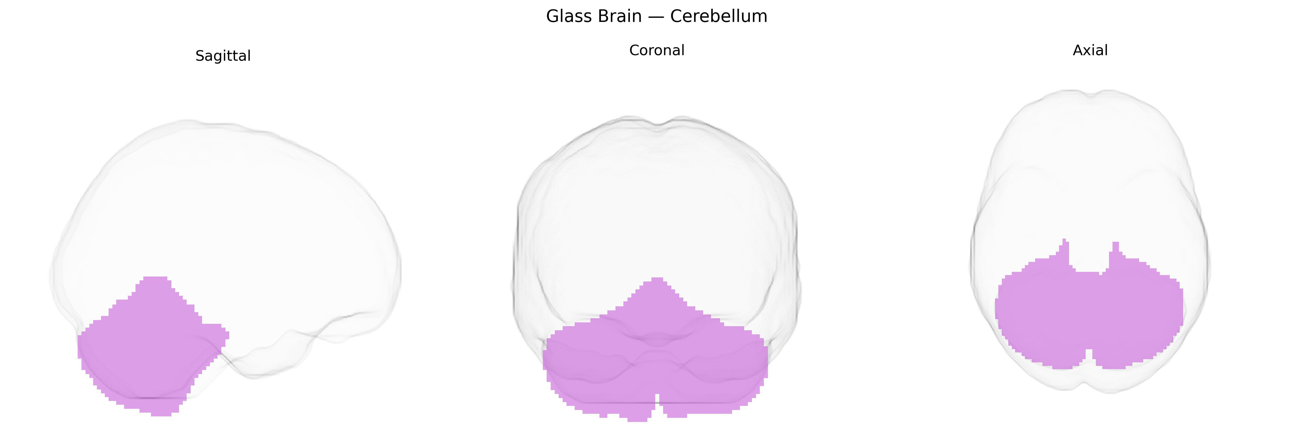 Triplanar Ghost Brain