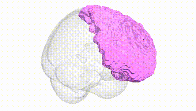 Full Brain White