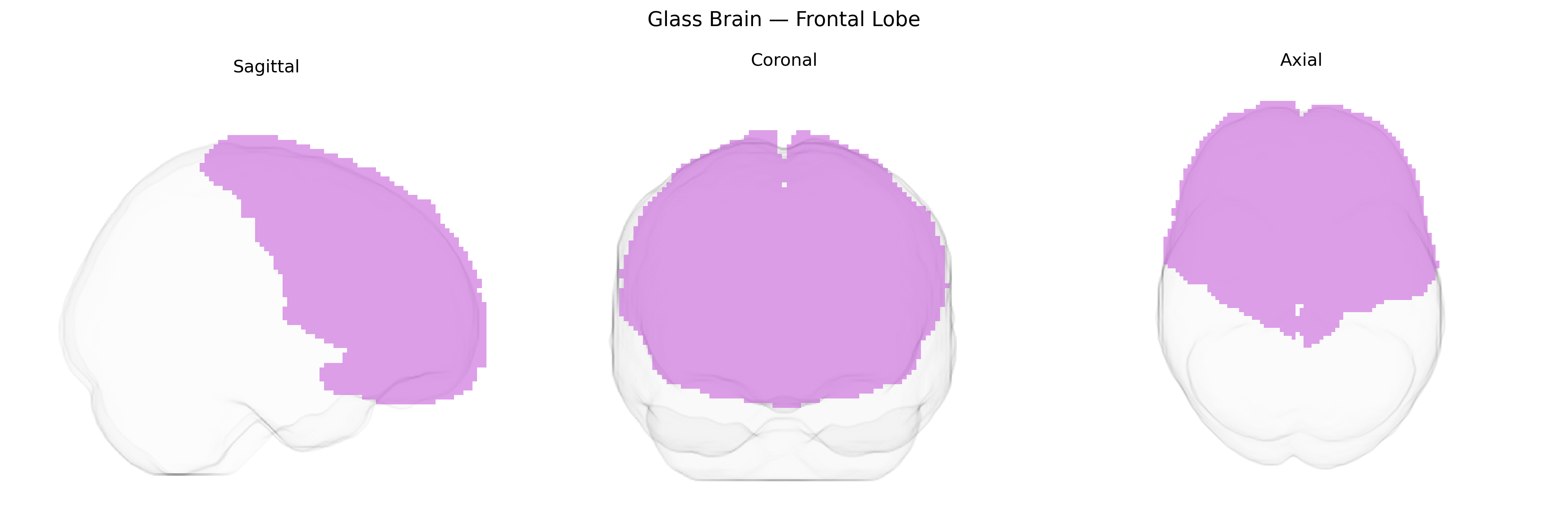 Triplanar Ghost Brain