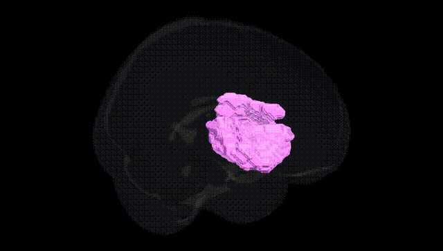 Full Brain Black