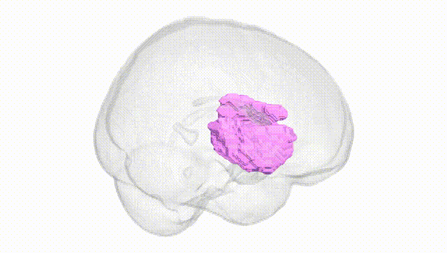 Full Brain White