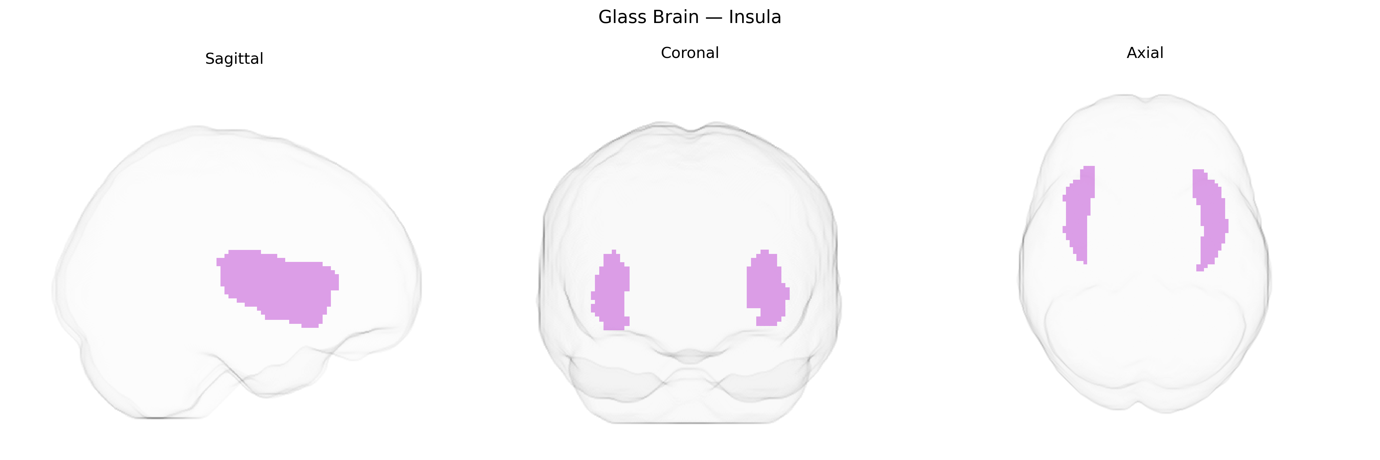 Triplanar Ghost Brain