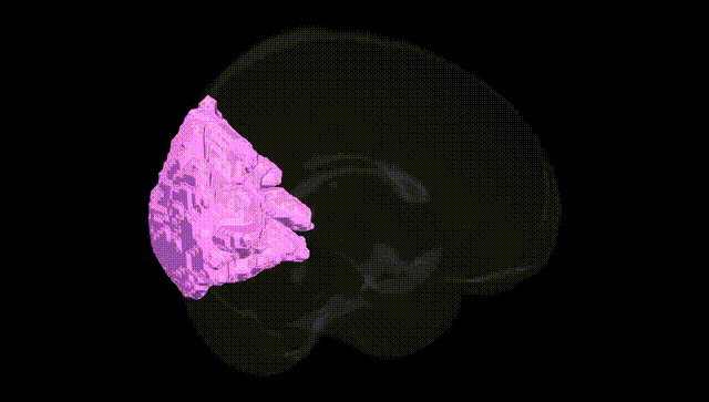 Full Brain Black
