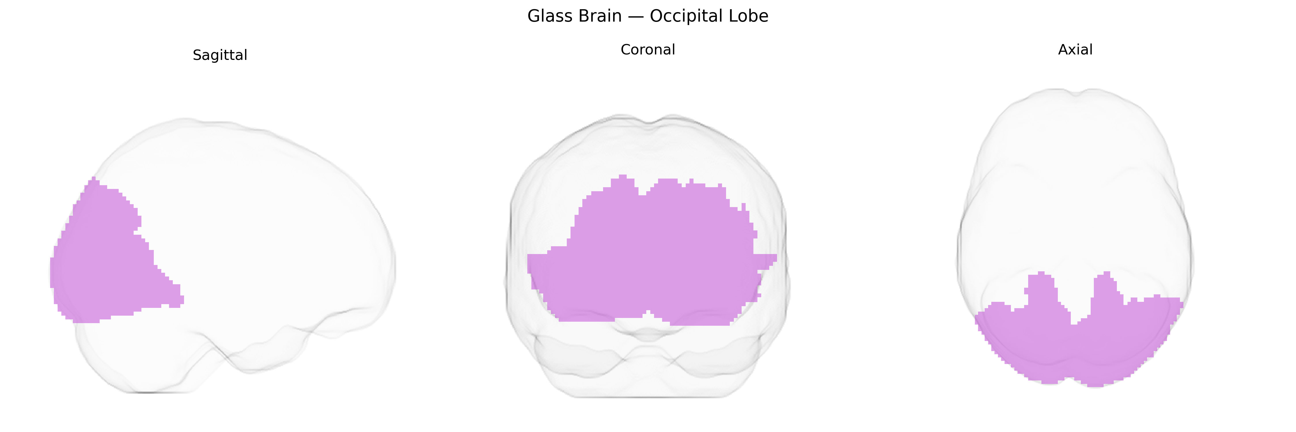 Triplanar Ghost Brain