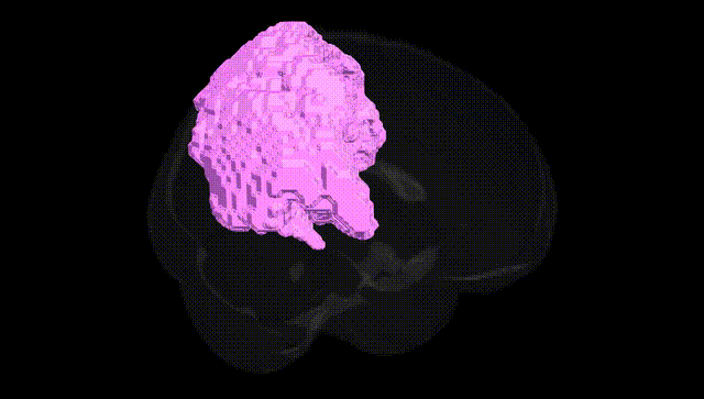 Full Brain Black