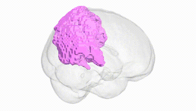 Full Brain White