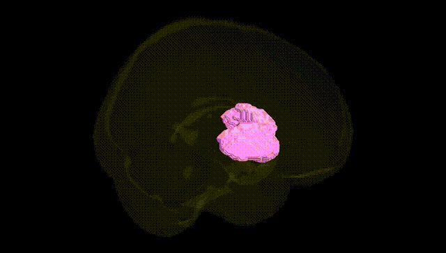 Full Brain Black