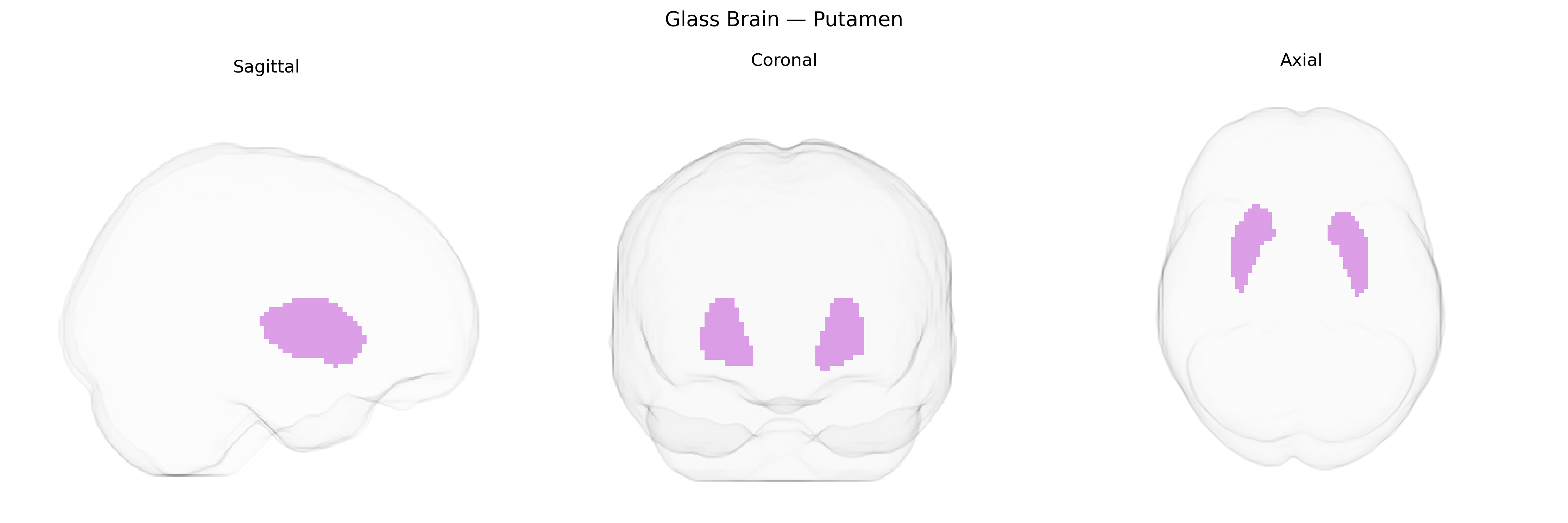 Triplanar Ghost Brain