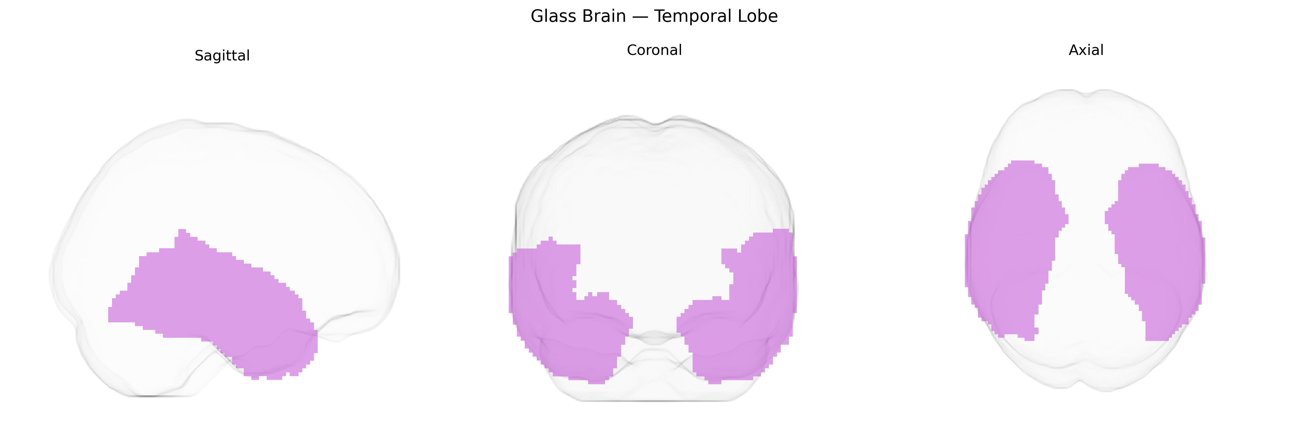 Triplanar Ghost Brain
