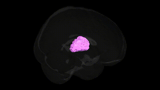 Full Brain Black