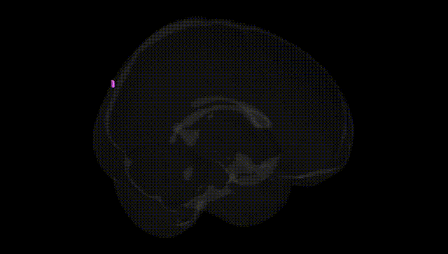 Full Brain Black