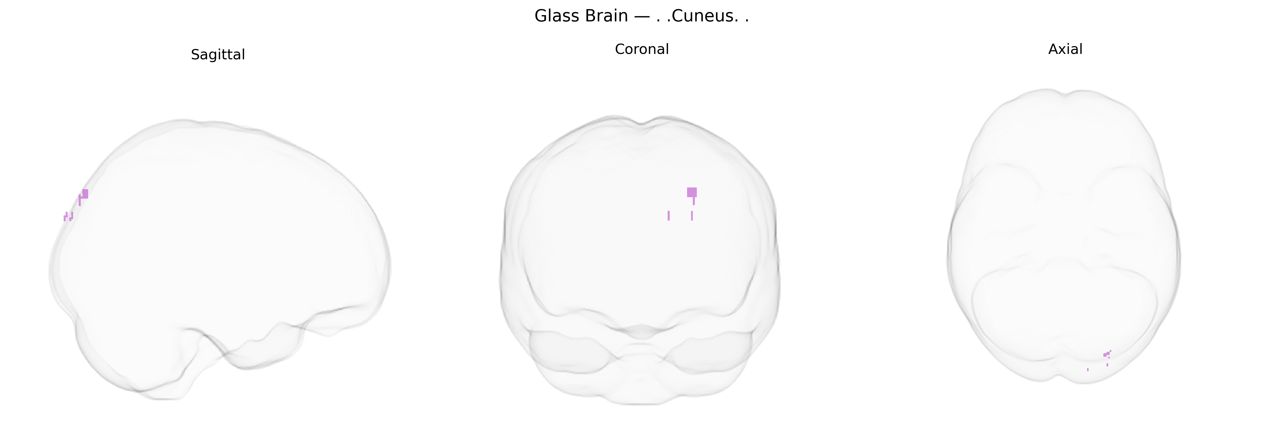 Triplanar Ghost Brain