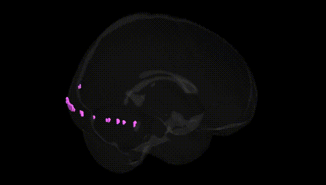 Full Brain Black